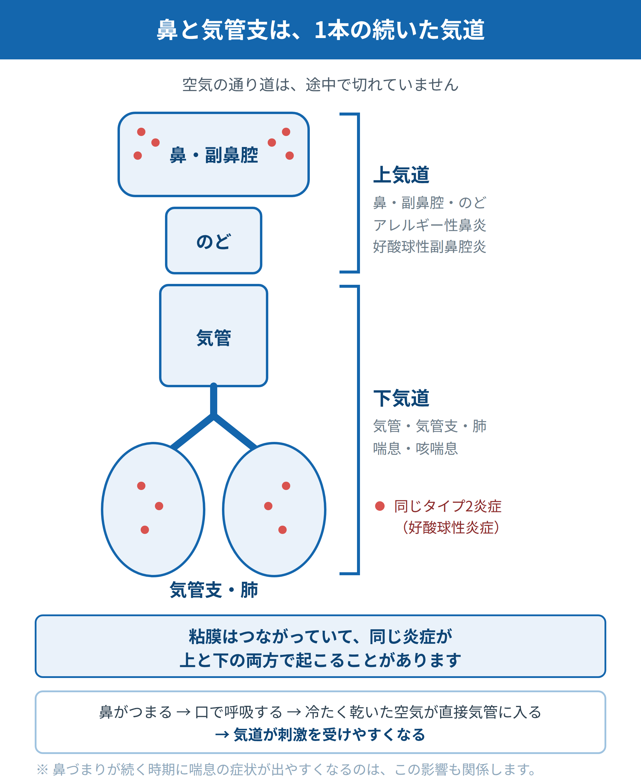 鼻・副鼻腔からのど、気管、気管支・肺までが1本の気道としてつながっていることを示した模式図。上気道と下気道の両方に同じタイプ2炎症（好酸球性炎症）が起こりうることを示している。